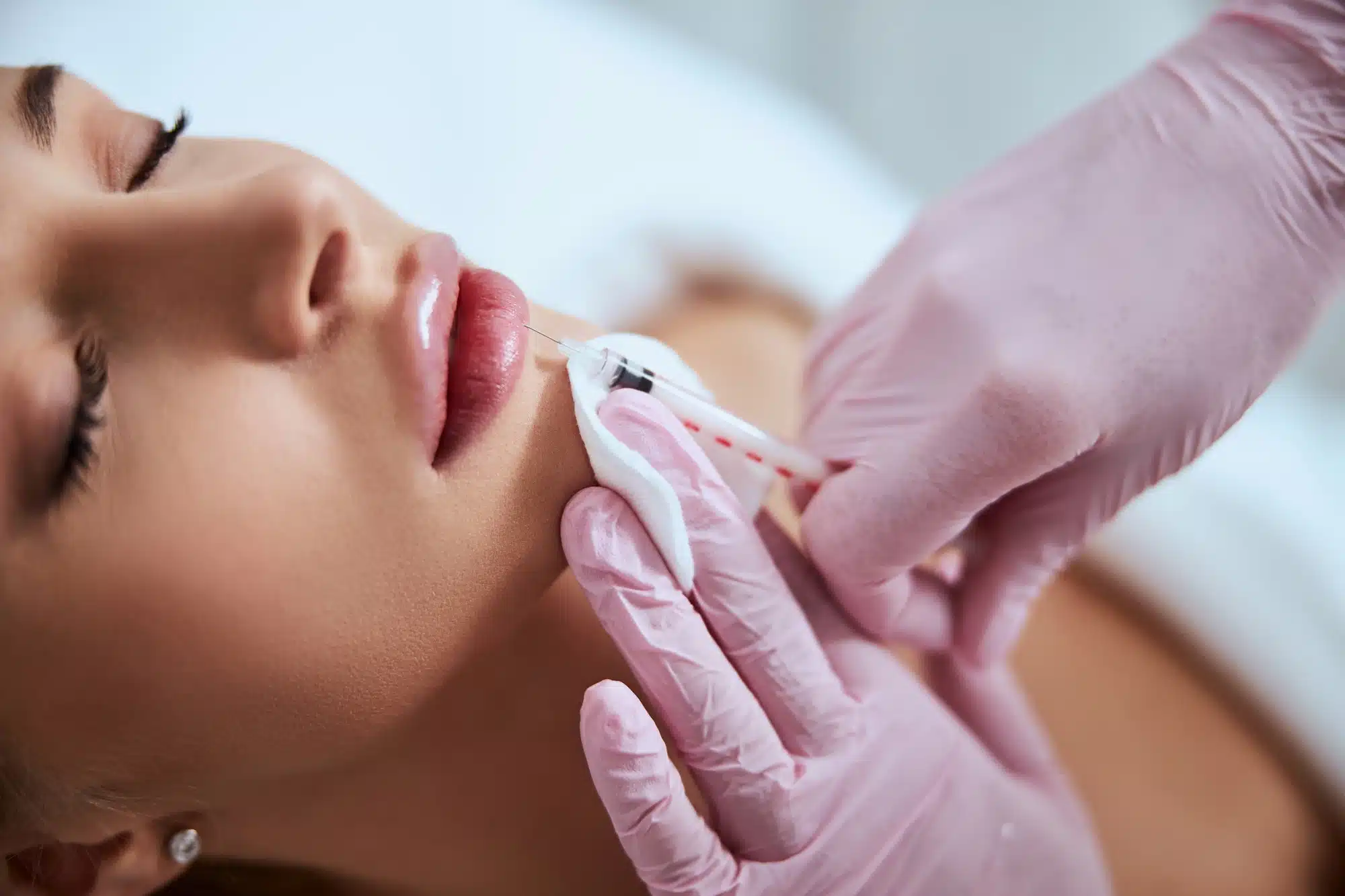https://shop.doctormedica.co/wp-content/uploads/2023/03/Restylane-For-Lips-Augmentation-Treatment-Overview.webp