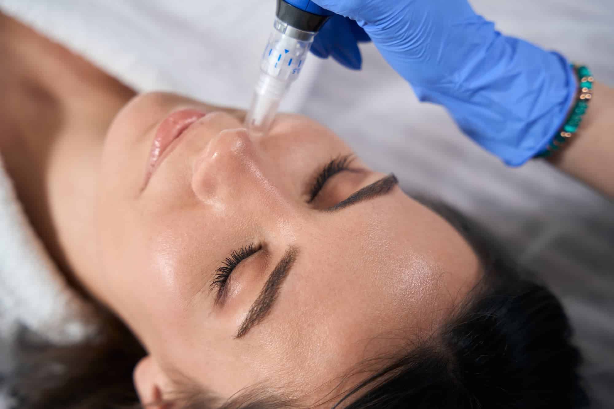 Maximizing Microneedling Benefits with LED Light Therapy