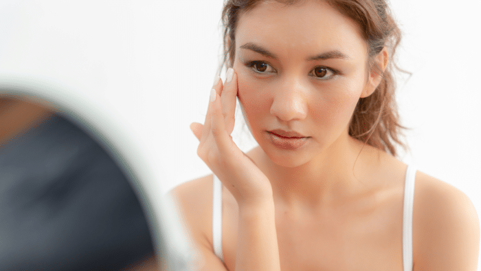  Woman concerned about skin dryness.