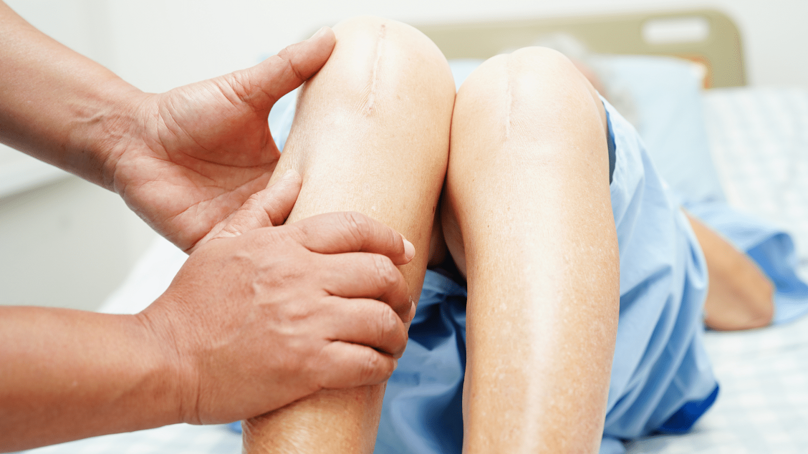 A healthcare professional inspecting the knee joint of a patient.