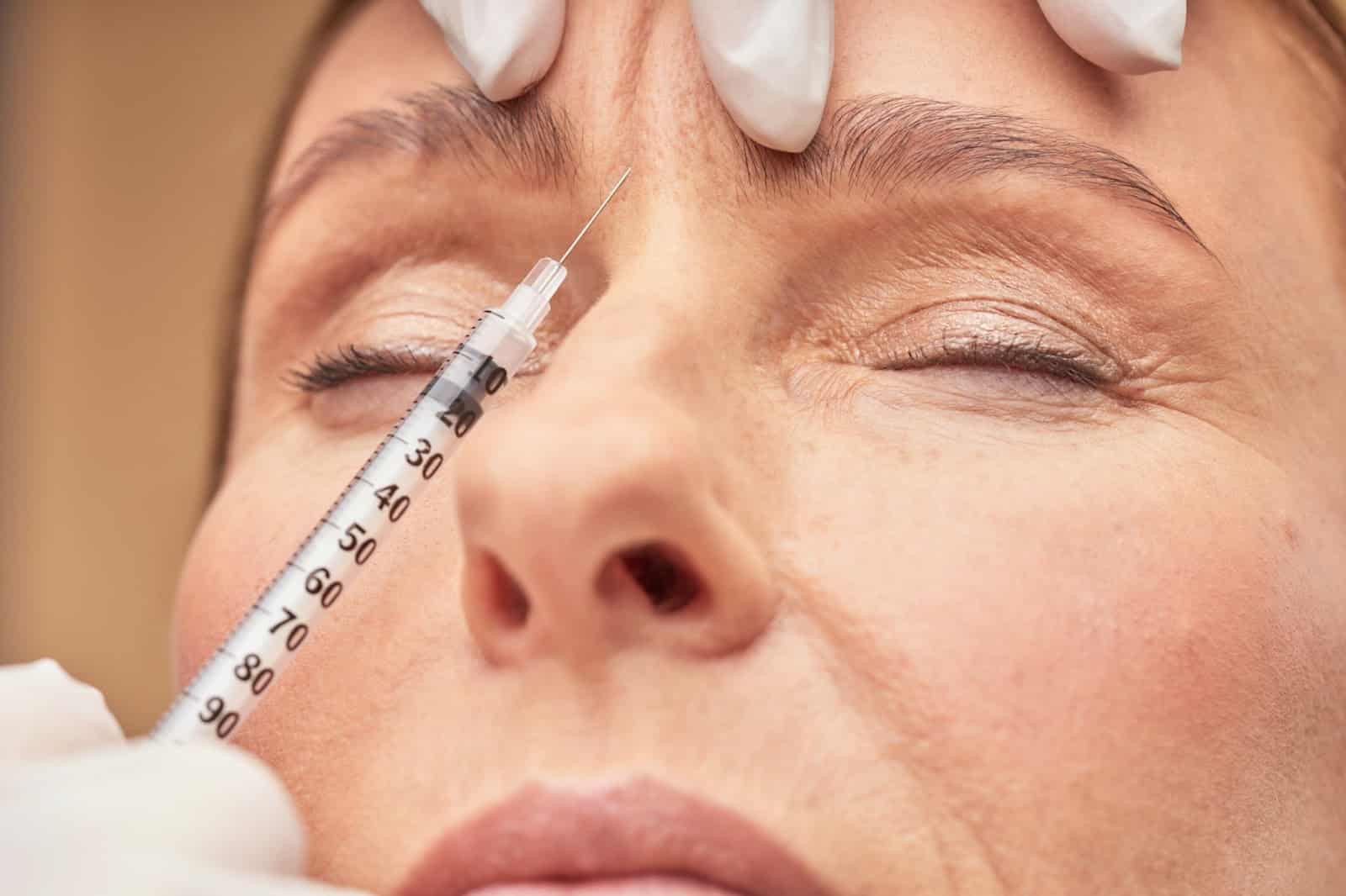 Botox injections to treat the glabellar lines.