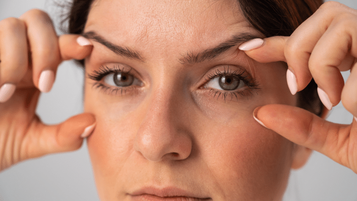 Woman bothered by visible signs of aging on her face.