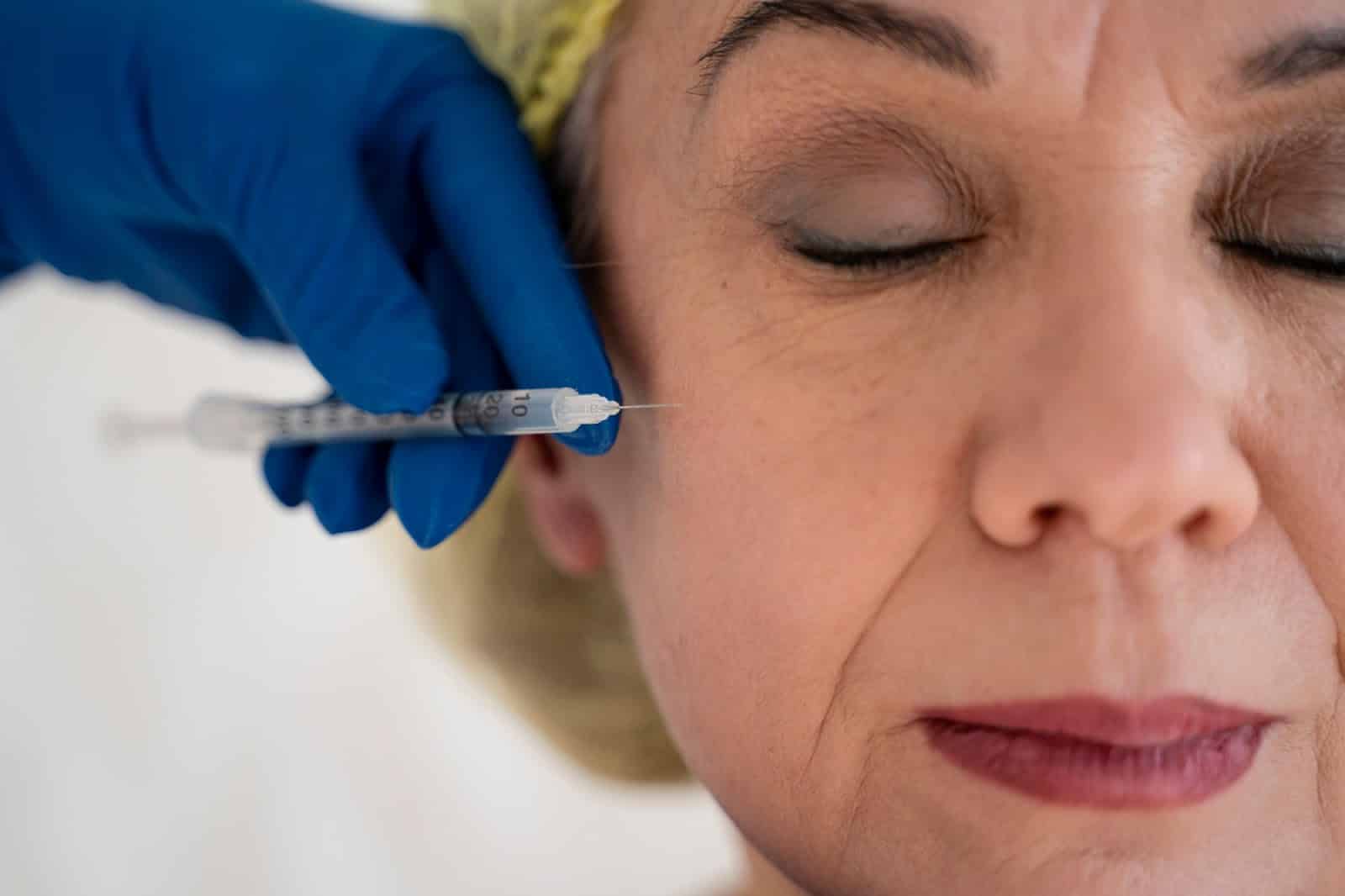 A female patient receives Botox injections to achieve facial rejuvenation.