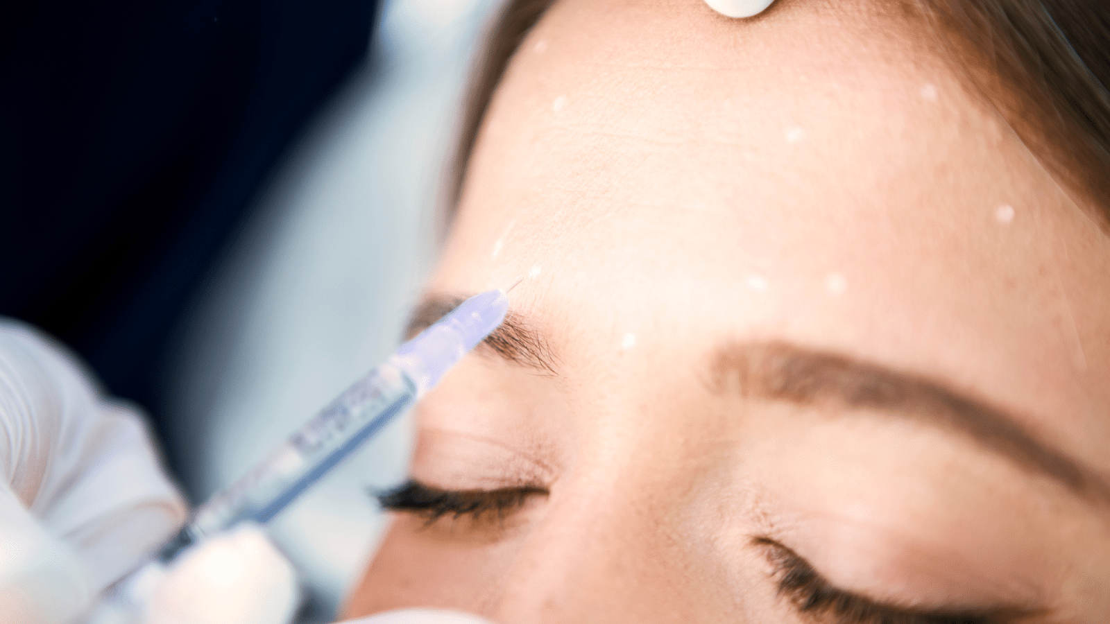 Young patient receiving Botox as a preventative treatment against wrinkles.
