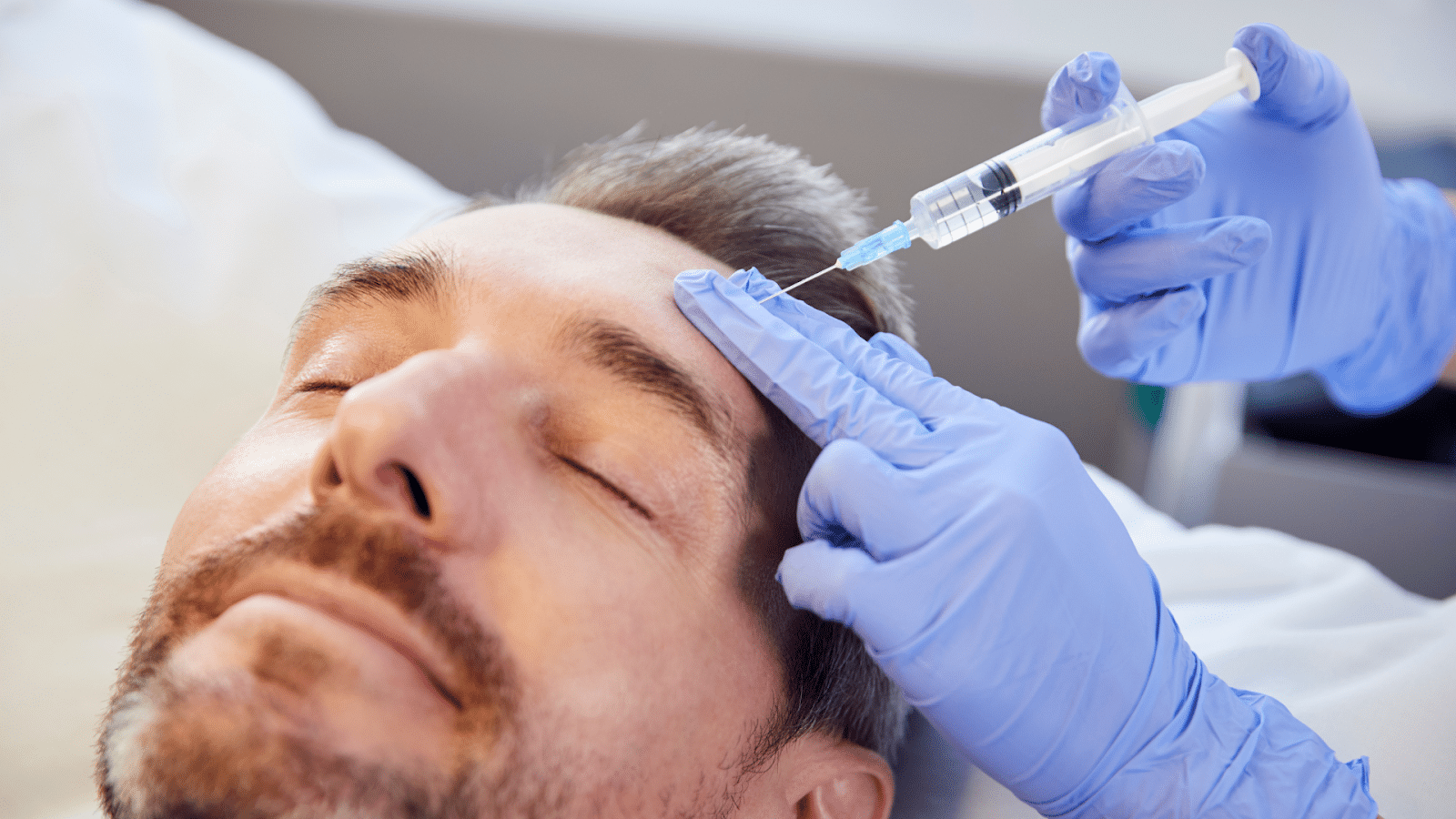 Male patient in his 40s receiving Botox injections to address forehead lines.