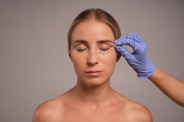 A healthcare professional determines the severity of under eye wrinkles in a female patient.