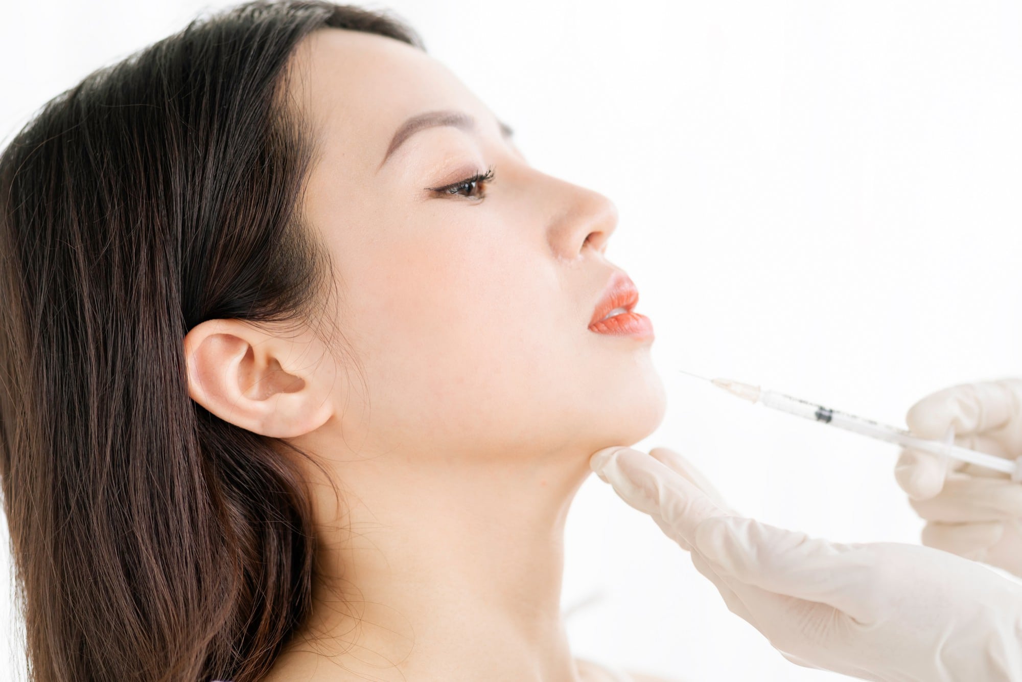A woman undergoes chin enhancement procedure using Dysport.