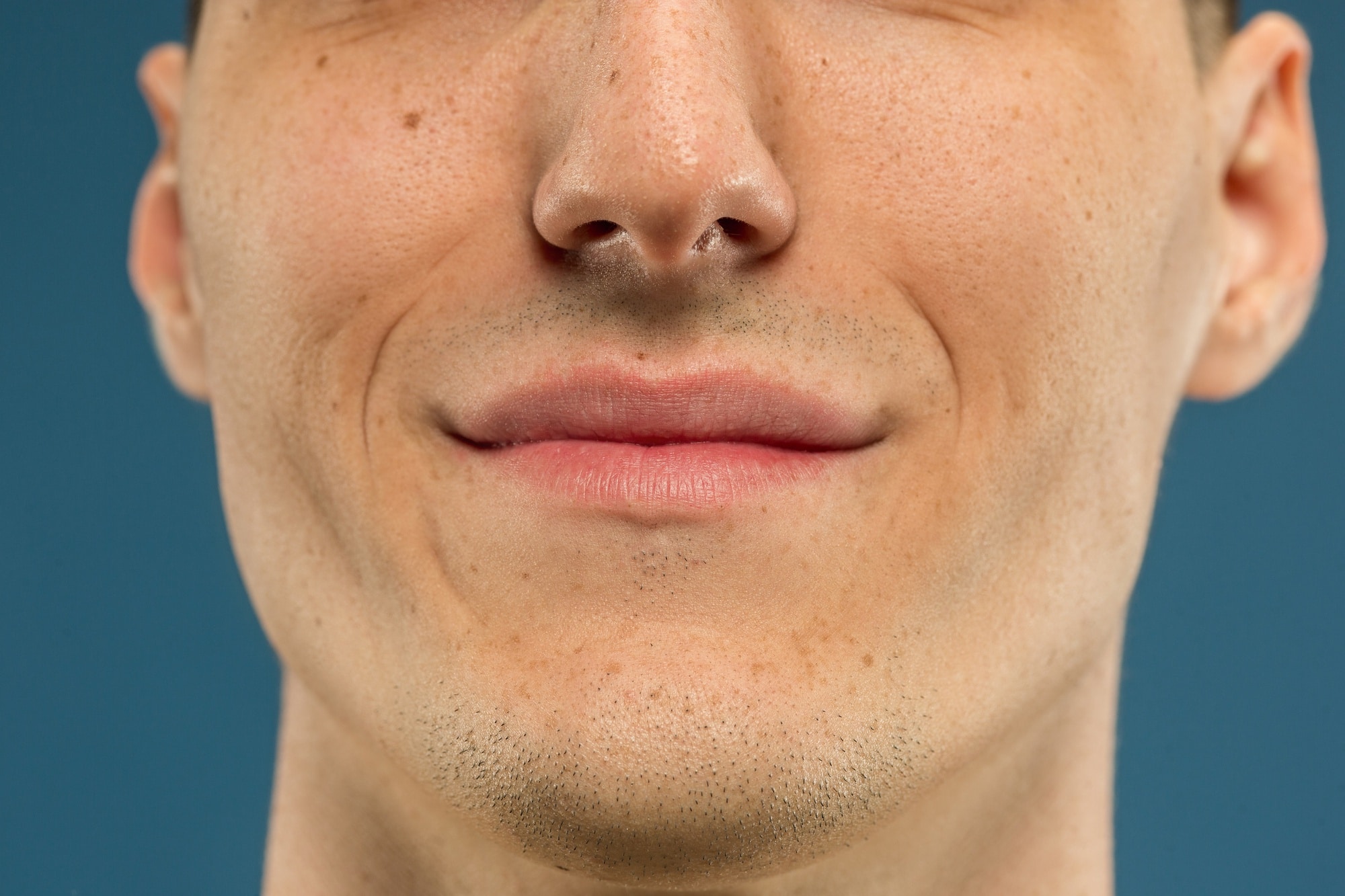 Nasolabial folds on the face of a male individual.