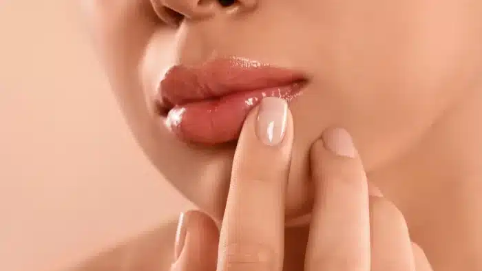 1 (16)