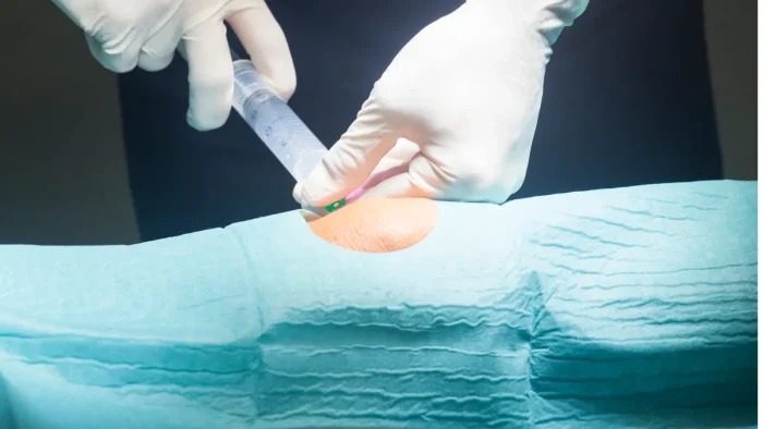 Knee injections.