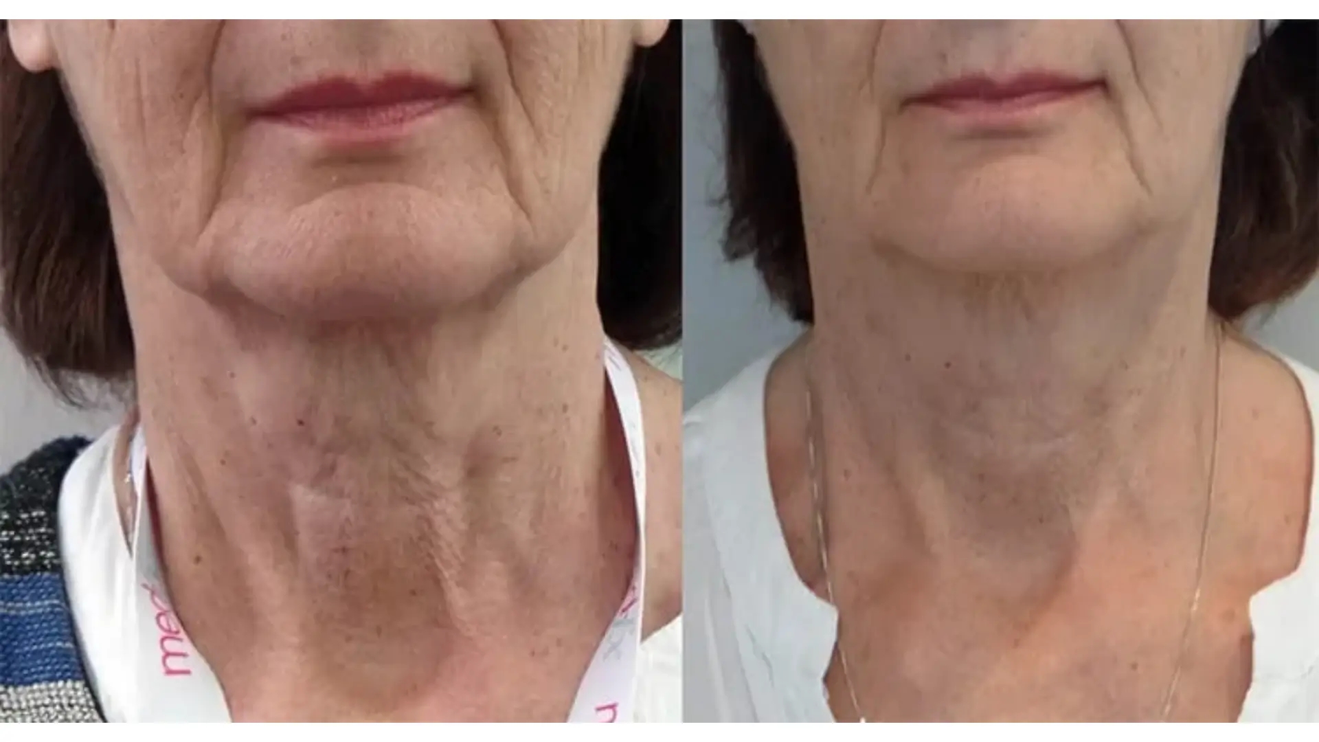 Before and After Images 1