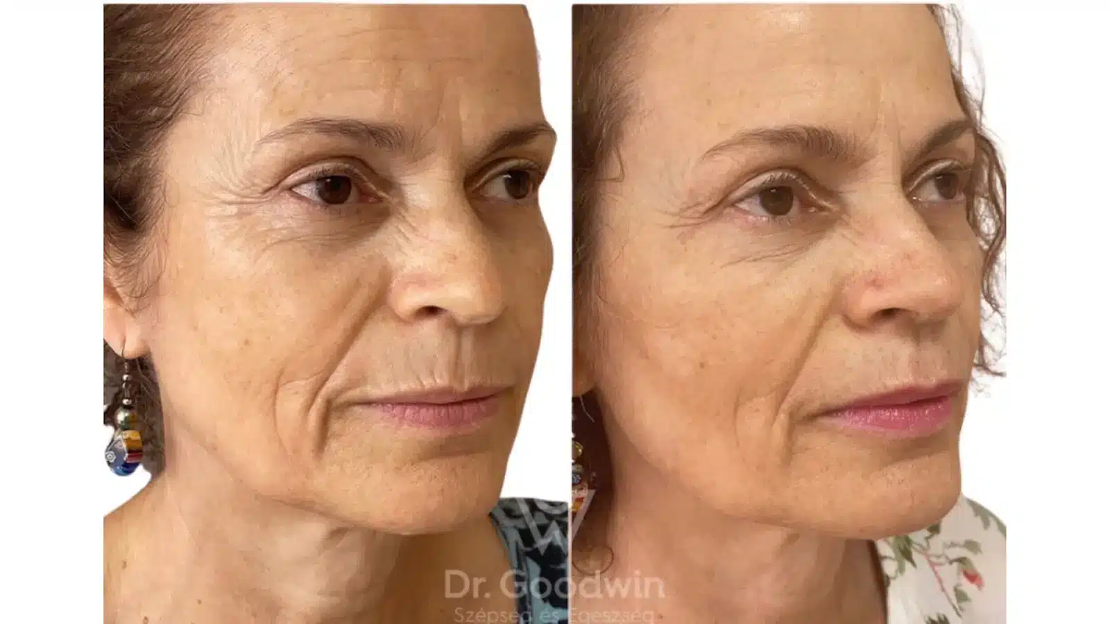 Case Studies and Patient Experiences 1