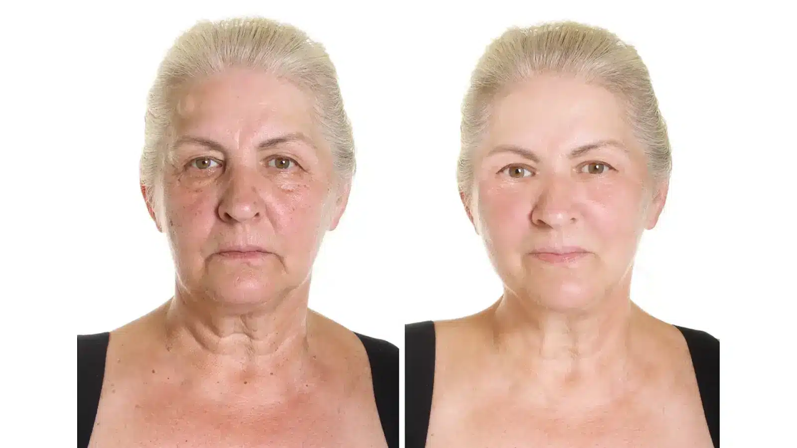 Case Studies and Patient Experiences 2