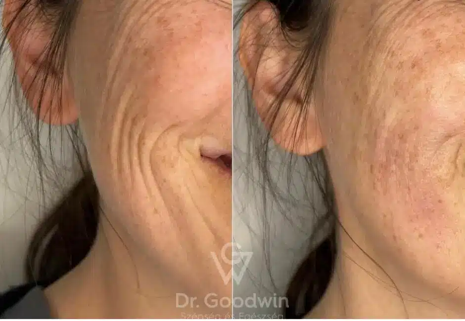 Ejal 40 Before And After Pictures 1