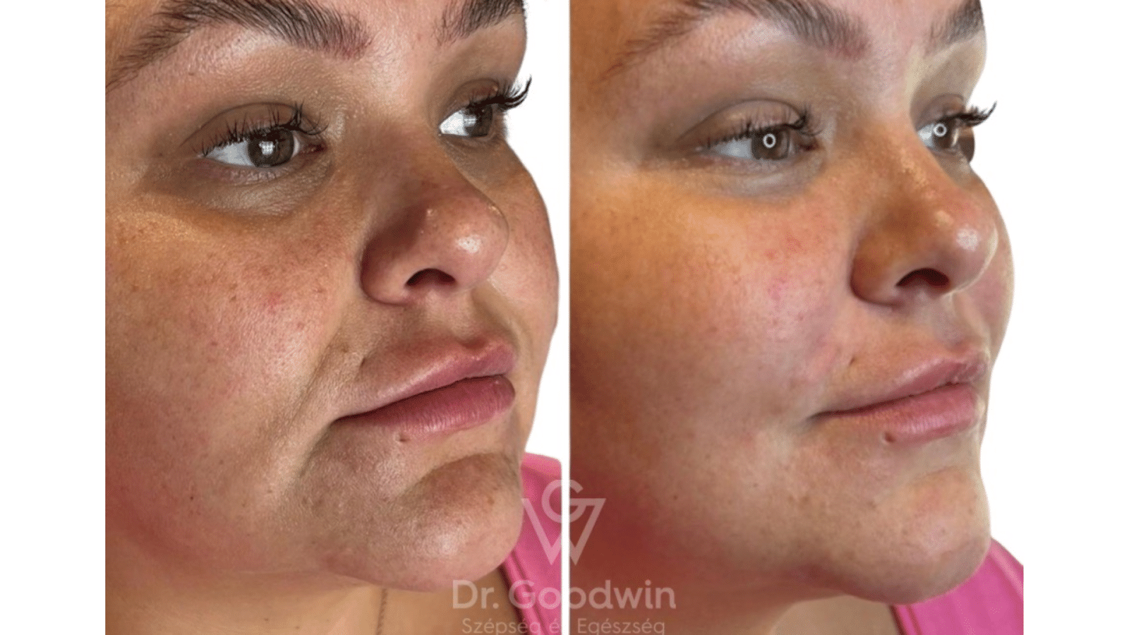 Ejal 40 Before And After Pictures