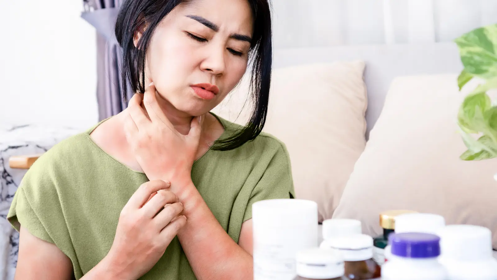 Woman with allergic reaction. 