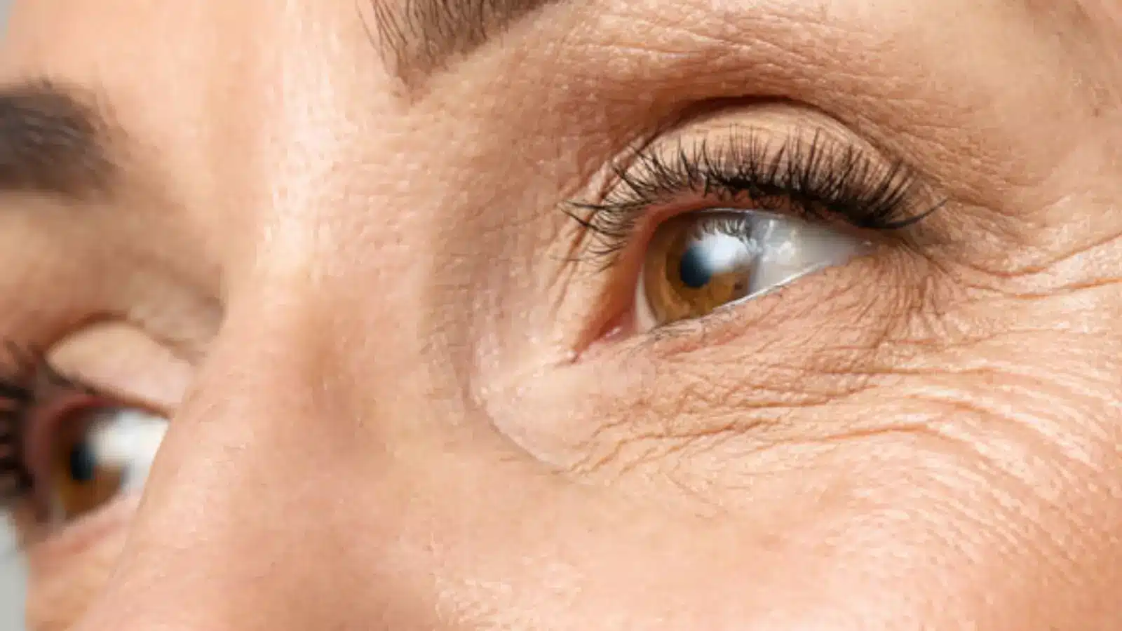 Stylage Under Eyes - Eliminate Crow's Feet - DoctorMedica
