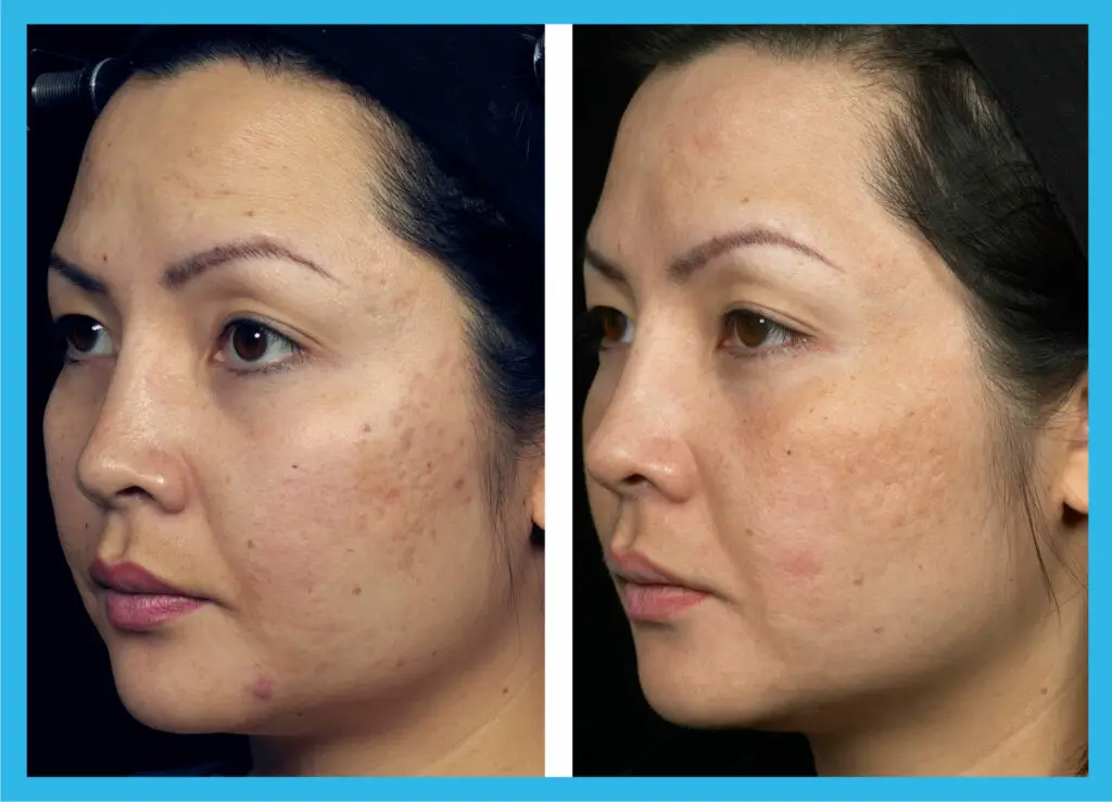 Before and after Cytocare