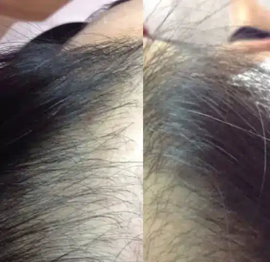 Before and After 1