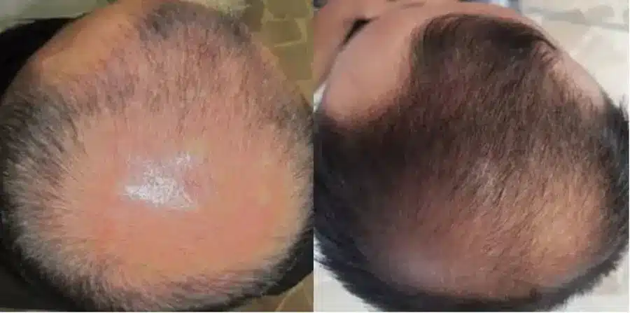 Before and After 2