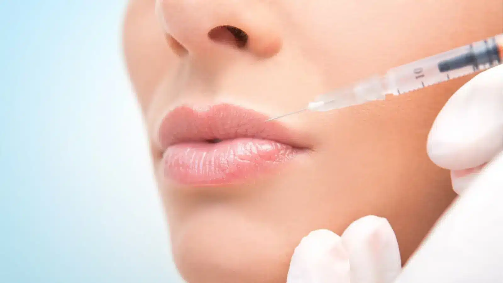 Close-up of lip filler treatment
