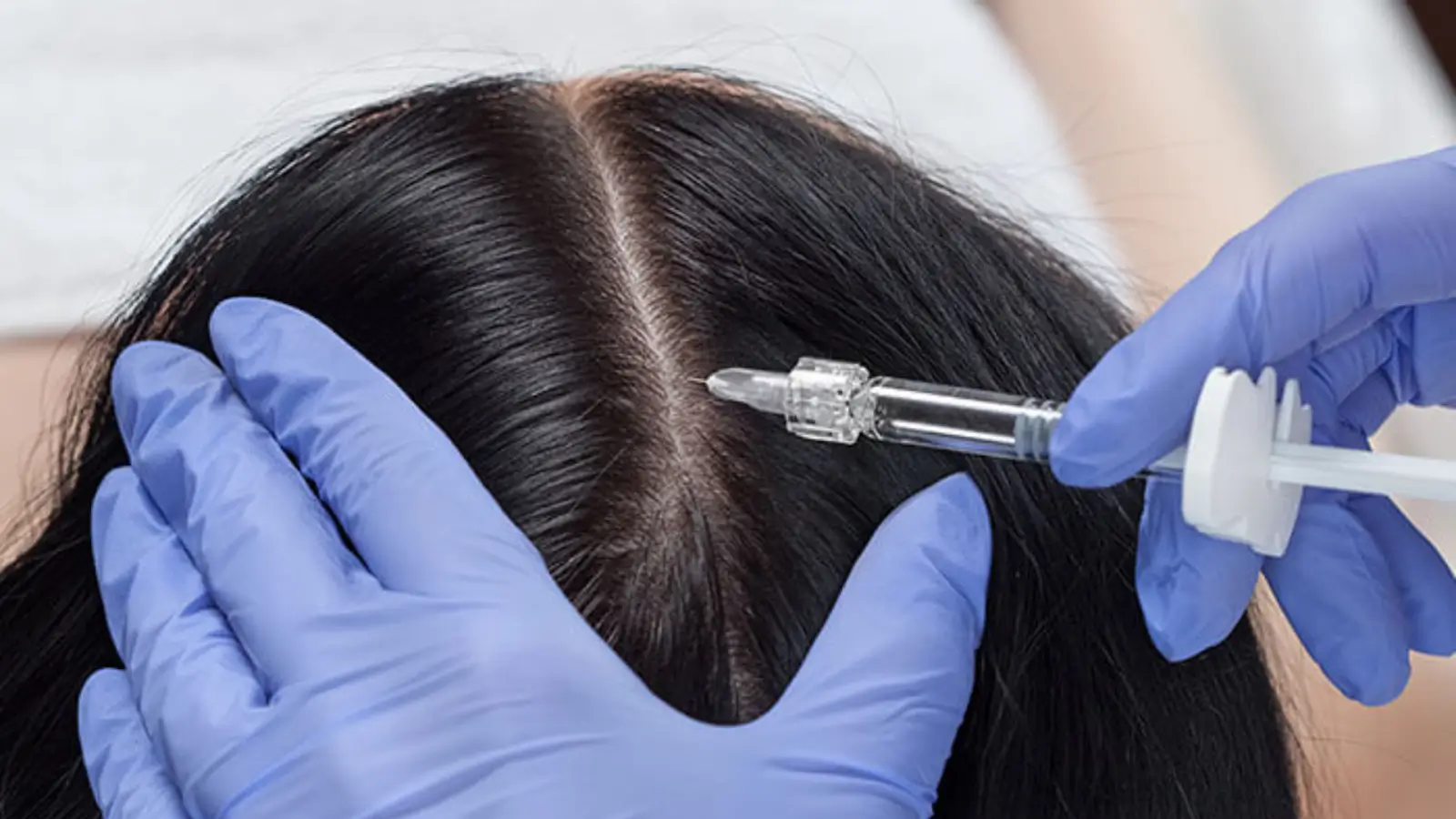 Hair injection.