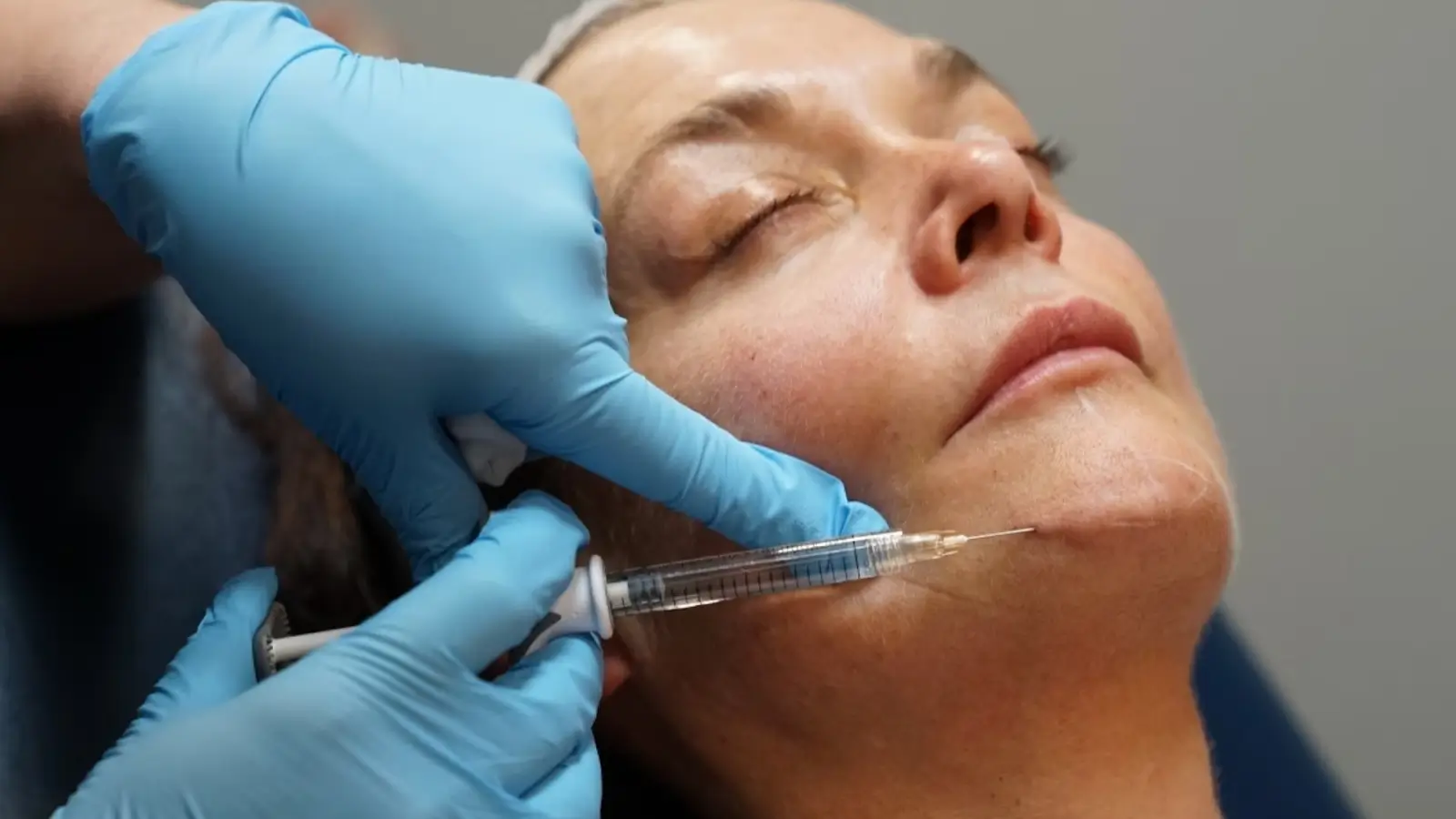 A patient receives dermal filler treatment.