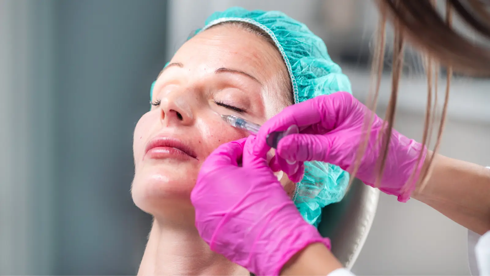 Woman receives filler treatment for facial rejuvenation.