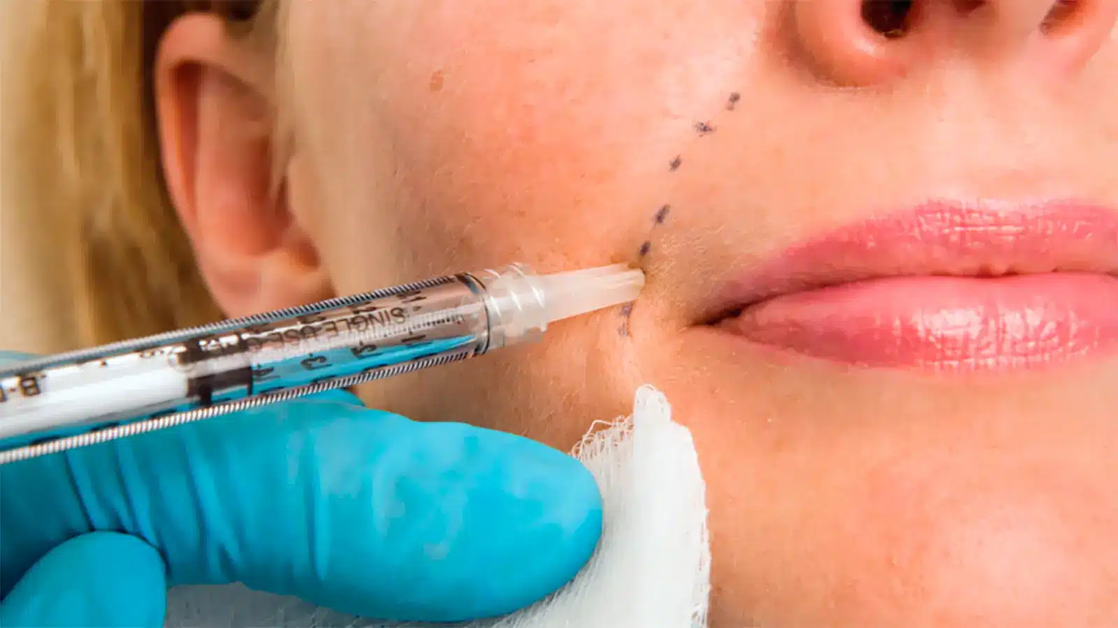 Person getting facial injection. 