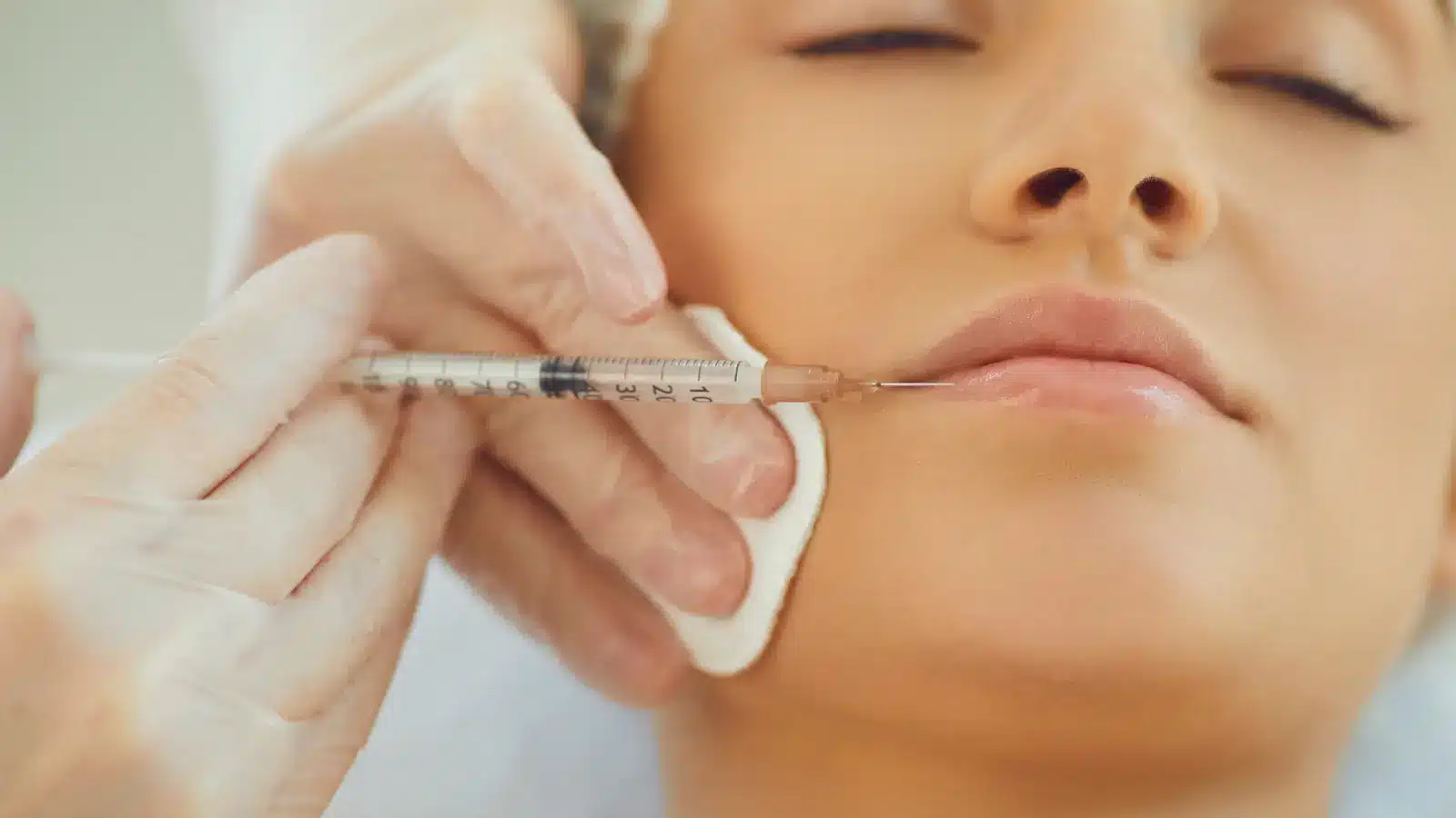 A healthcare professional administers lip filler.