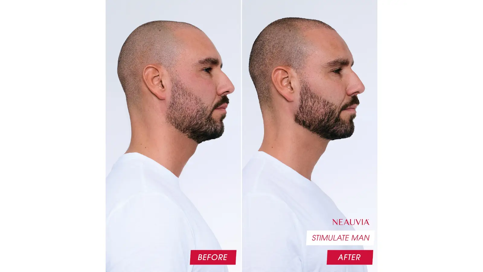 Before And After.