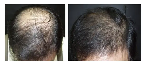 Real World Reviews and Patient Outcomes of Dr Cyj.