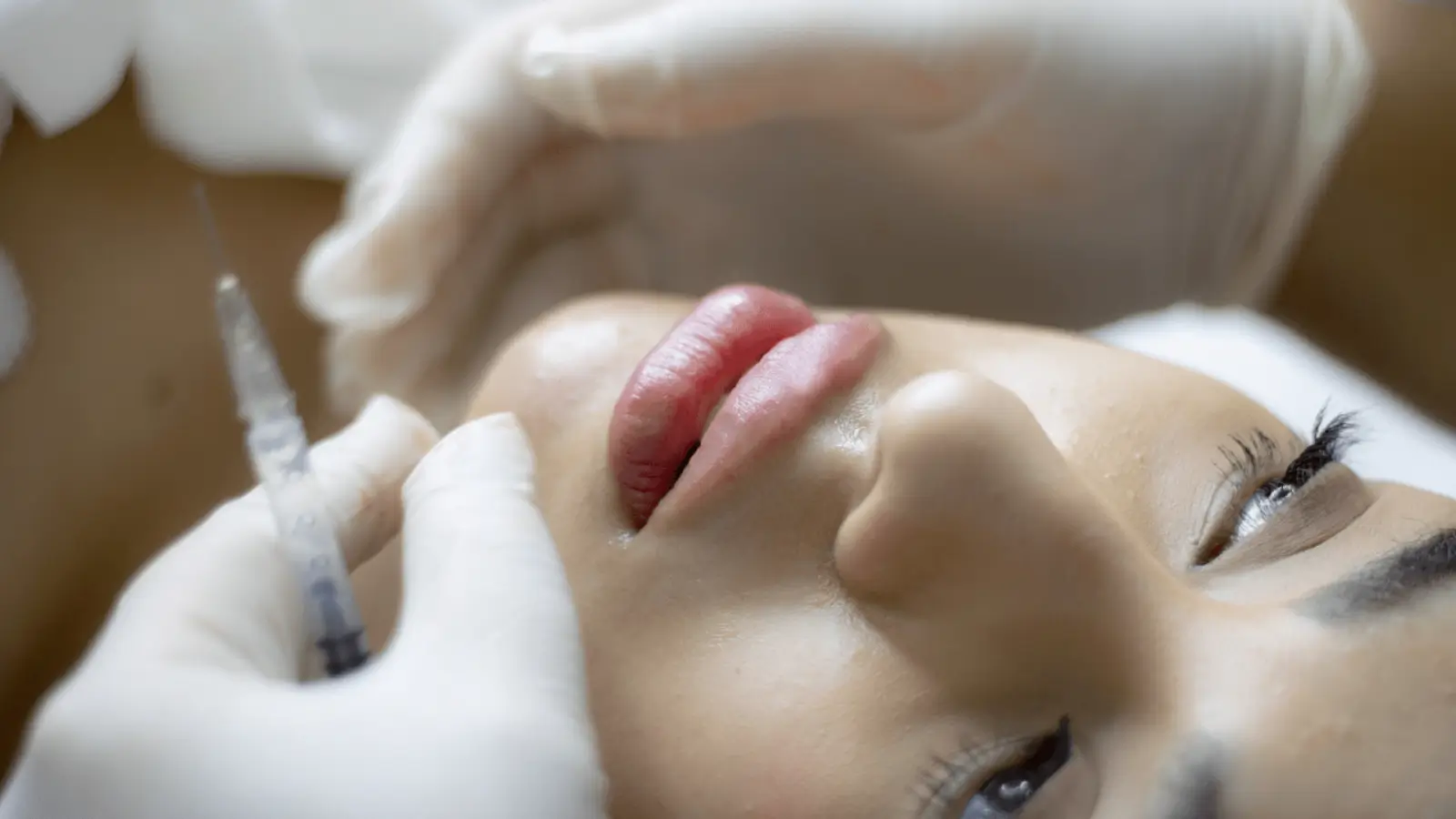 Woman getting the Cytocare treatment.