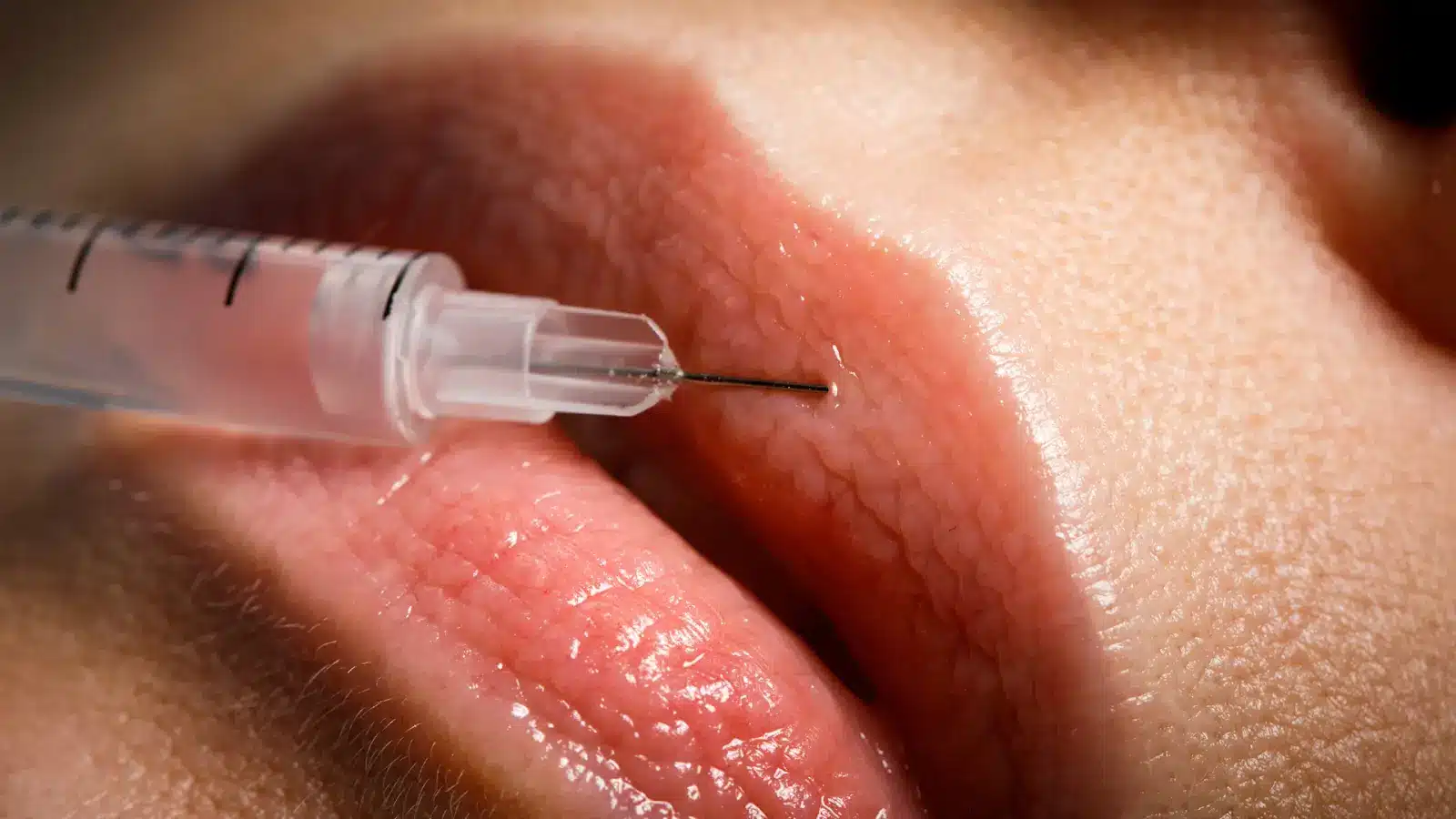 Lip injection.