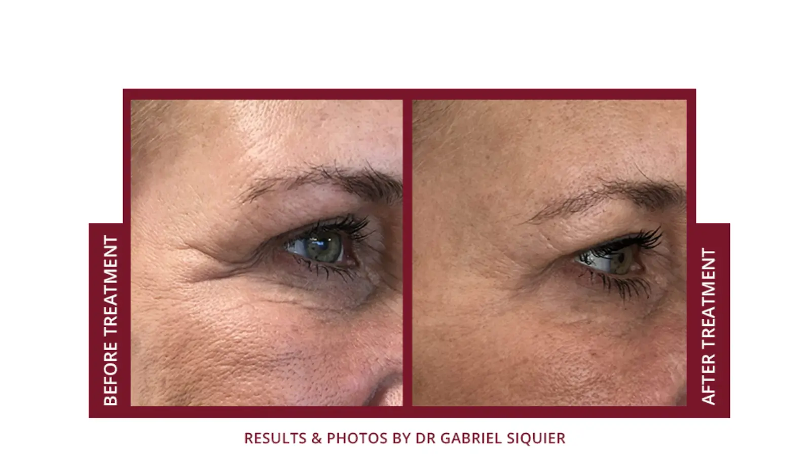Before and After comparison 2