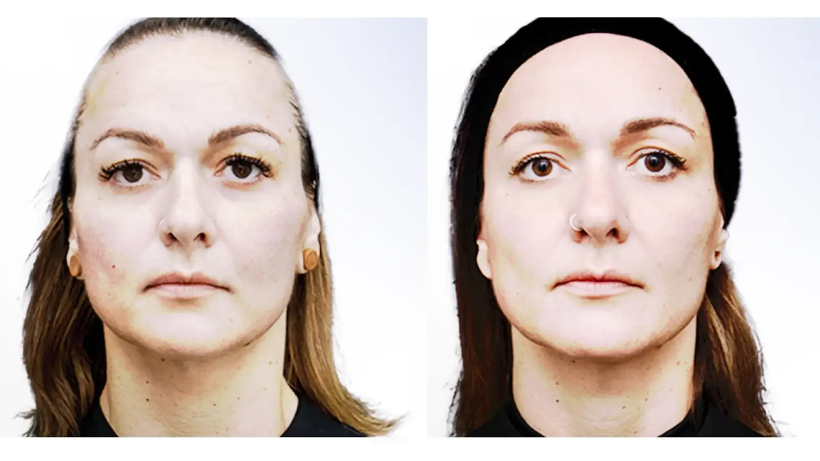Before and After Photo Examples 1