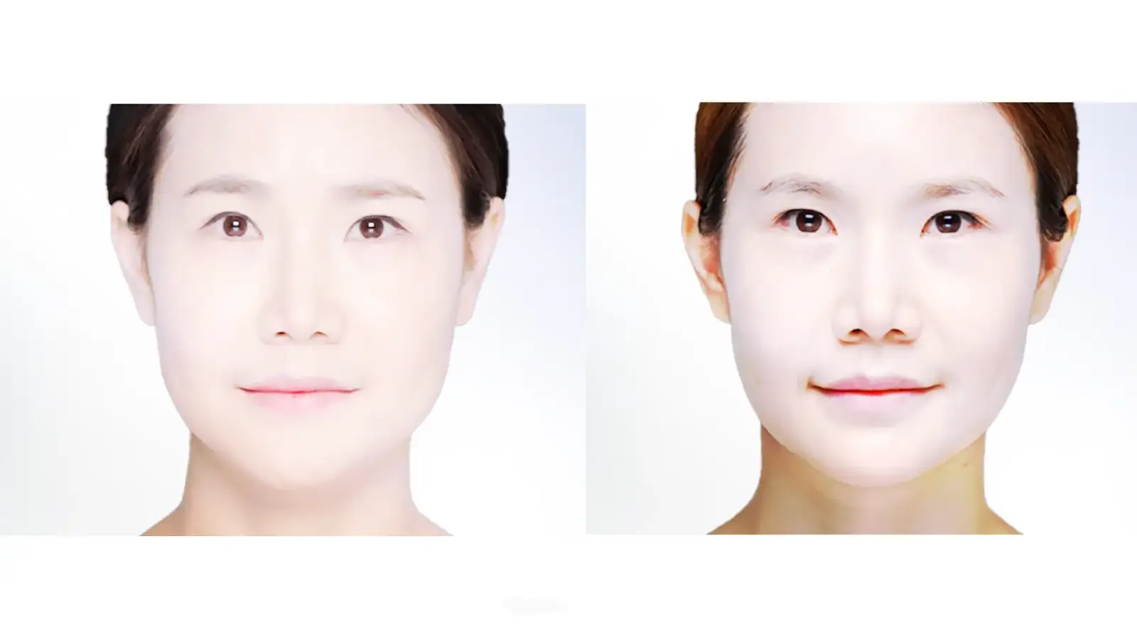 Before and After Photo Examples 2