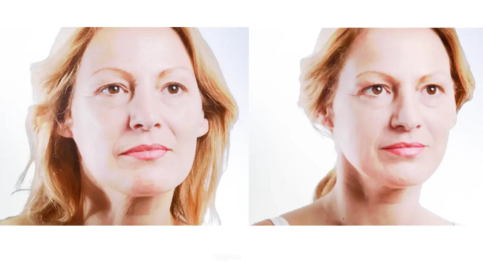 Before and After Photo Examples 3
