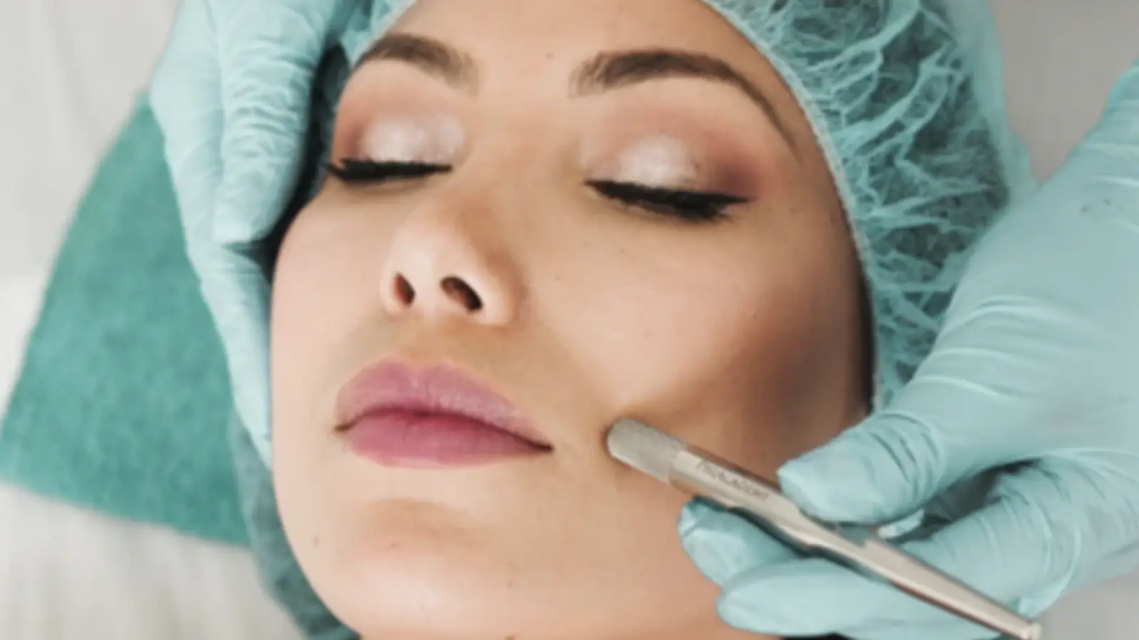 Best Practices for SoftFil Injection
