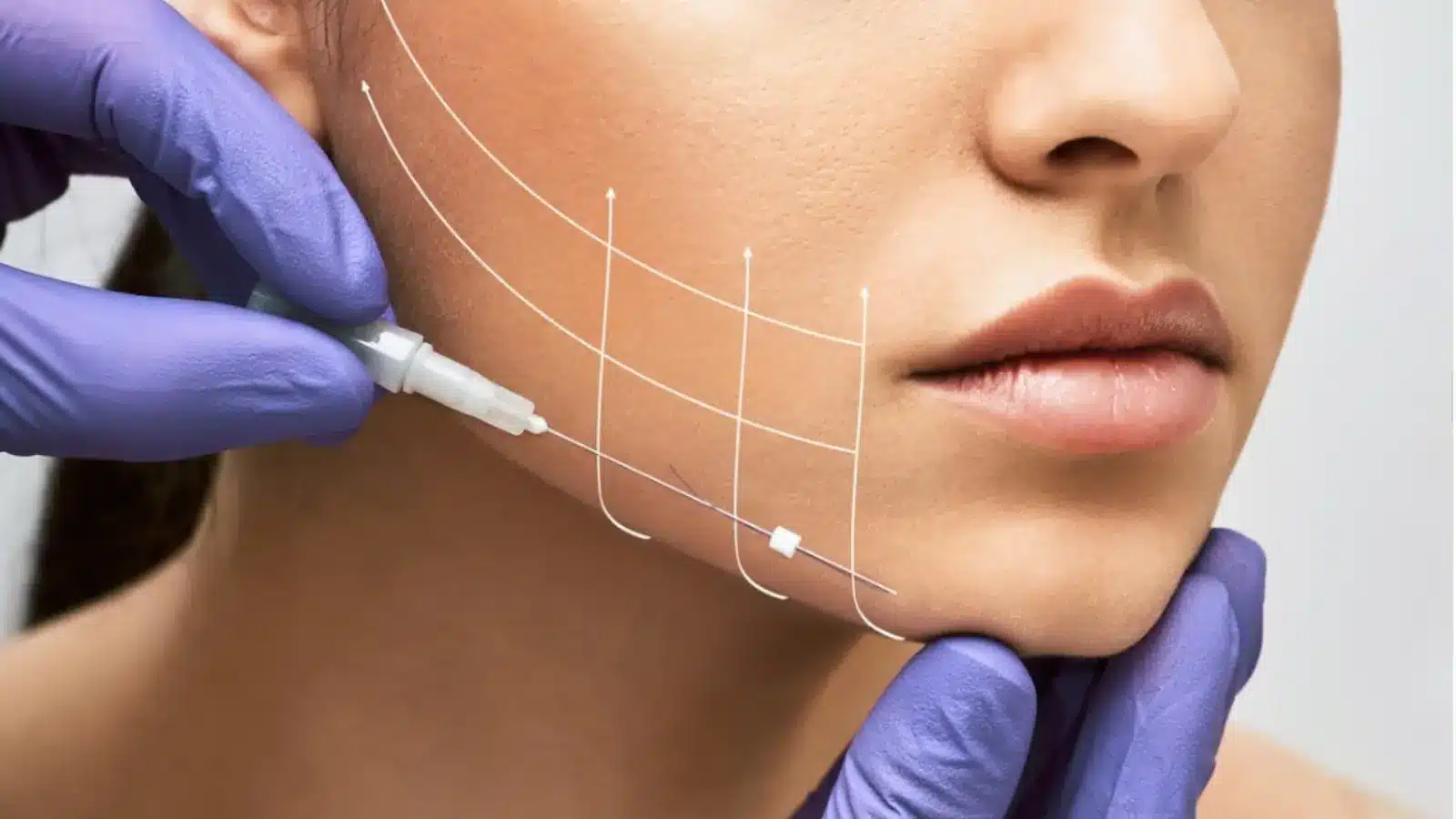 Woman's face getting threaded.