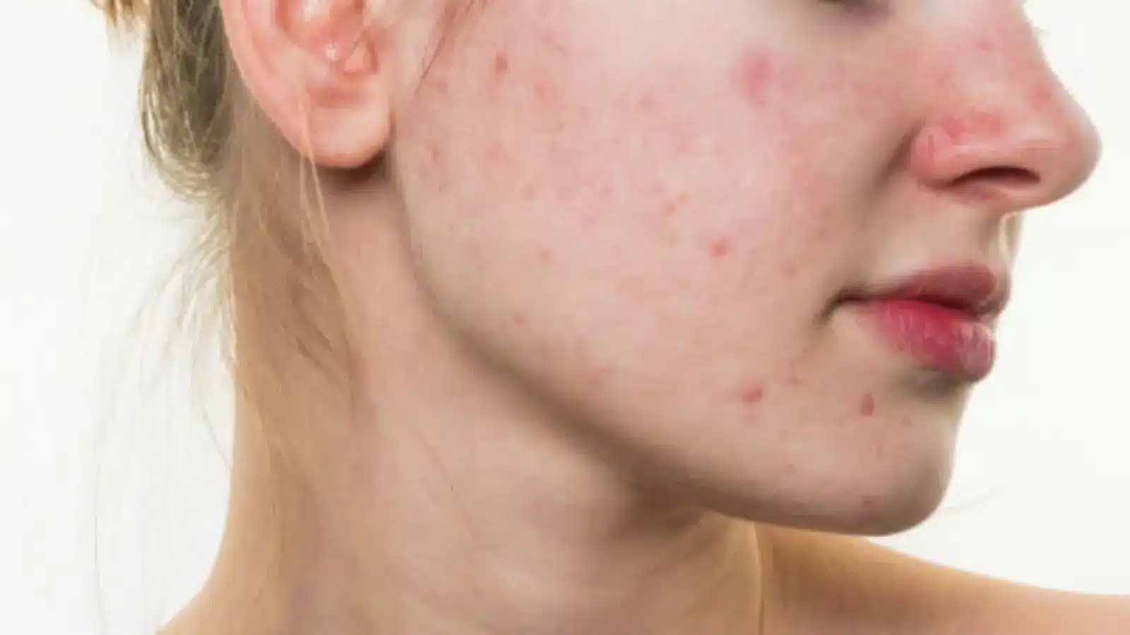 Woman with red skin.