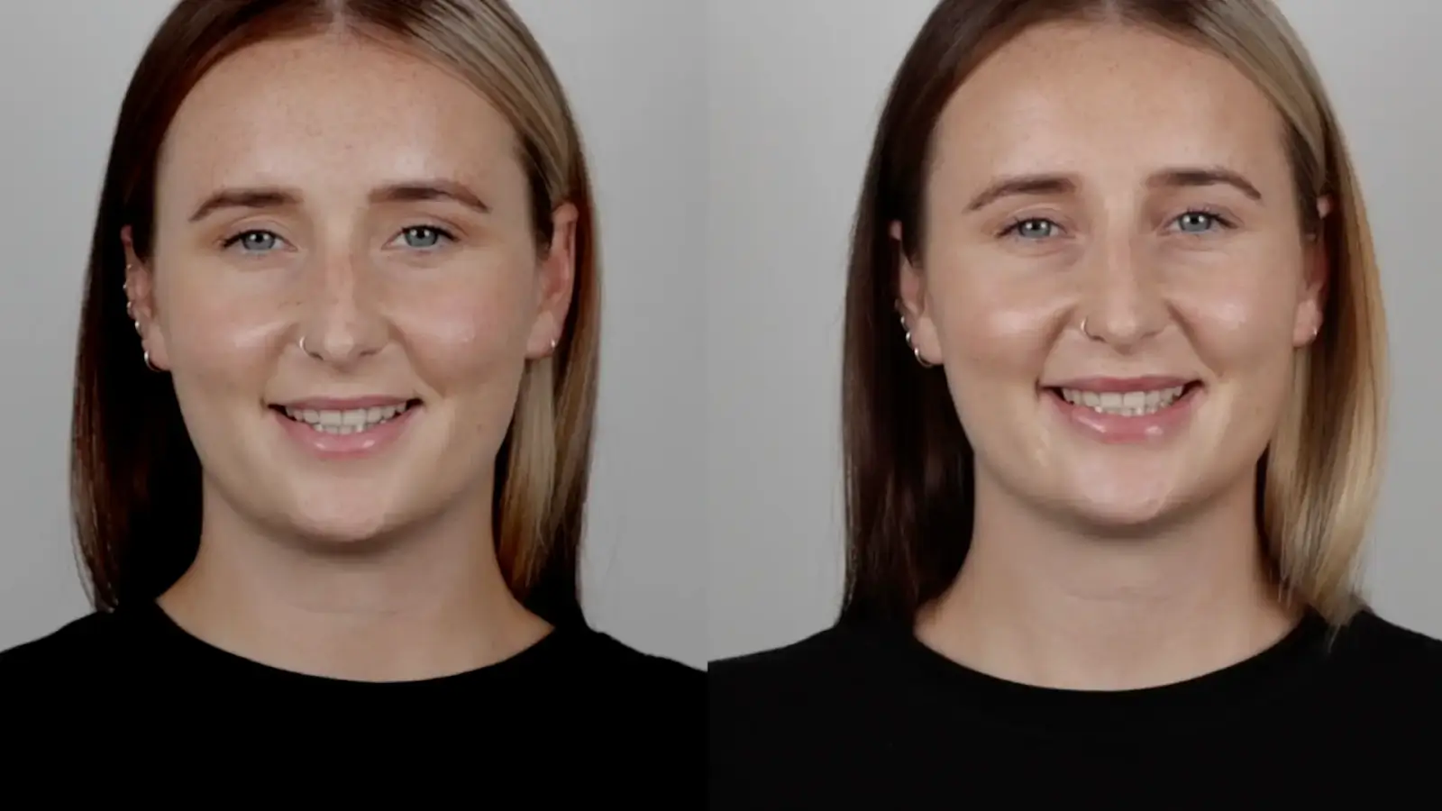 Before and after.
