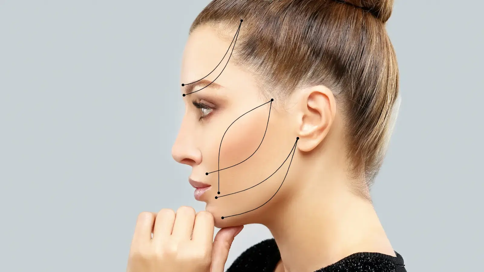 visual guide for thread lift procedure