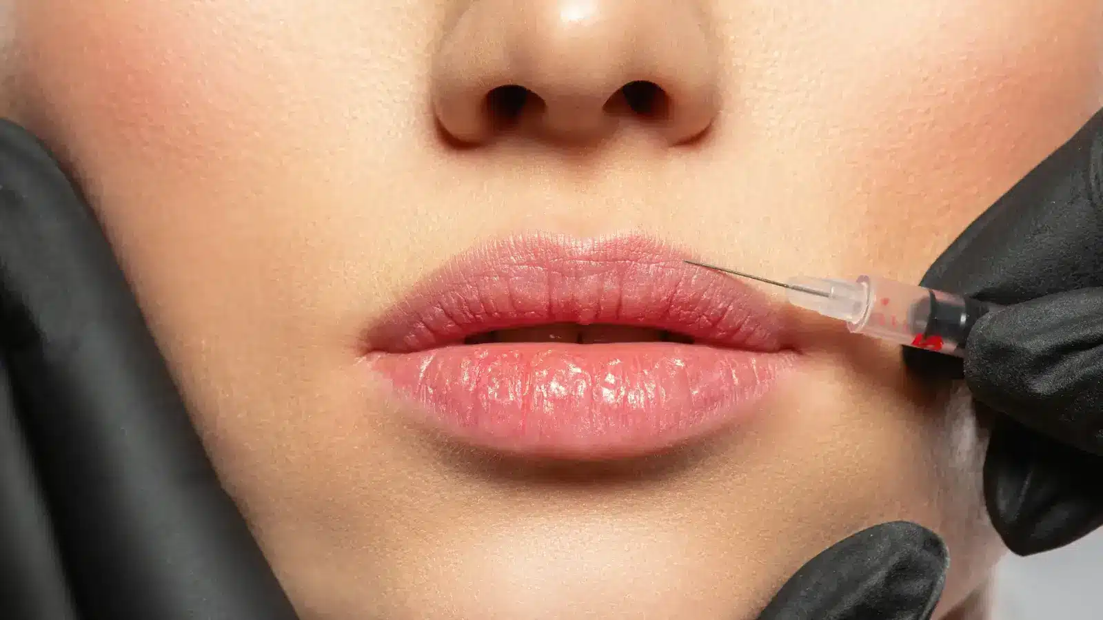 Lip injection.