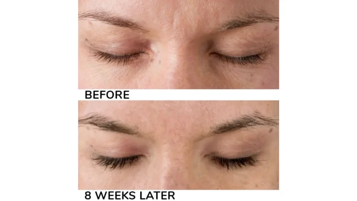 Before and After Photos 1