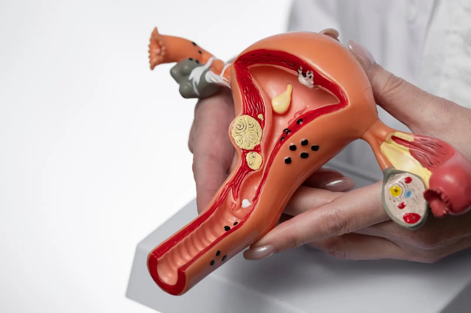 Female reproductive organ.