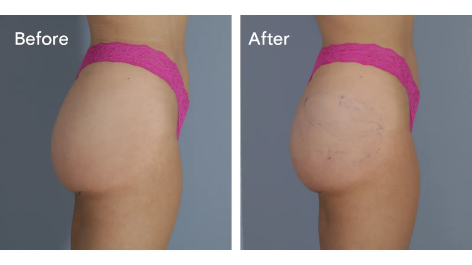Case Studies Highlighting Different Treatment Areas 1