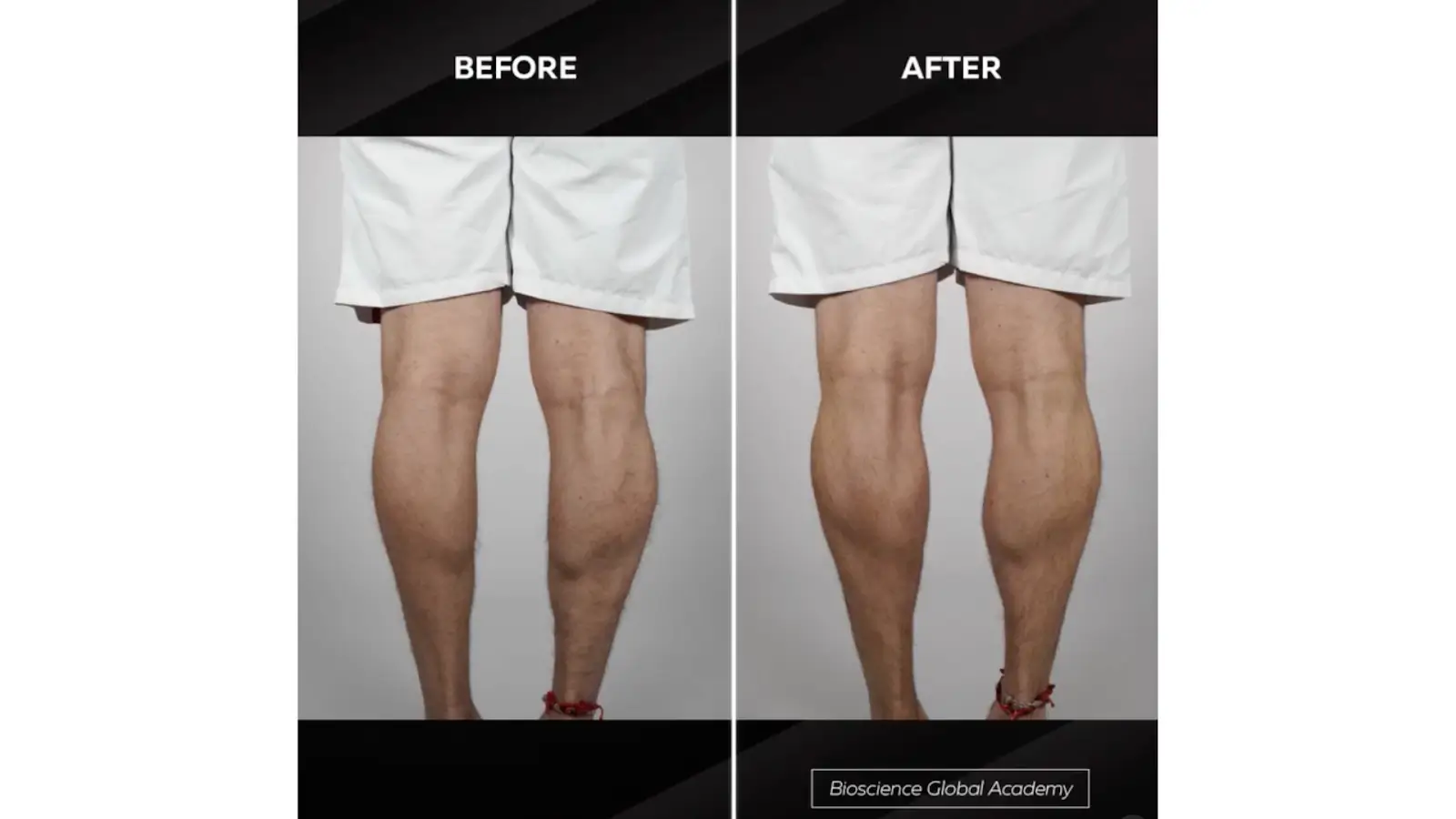 Case Studies Highlighting Different Treatment Areas