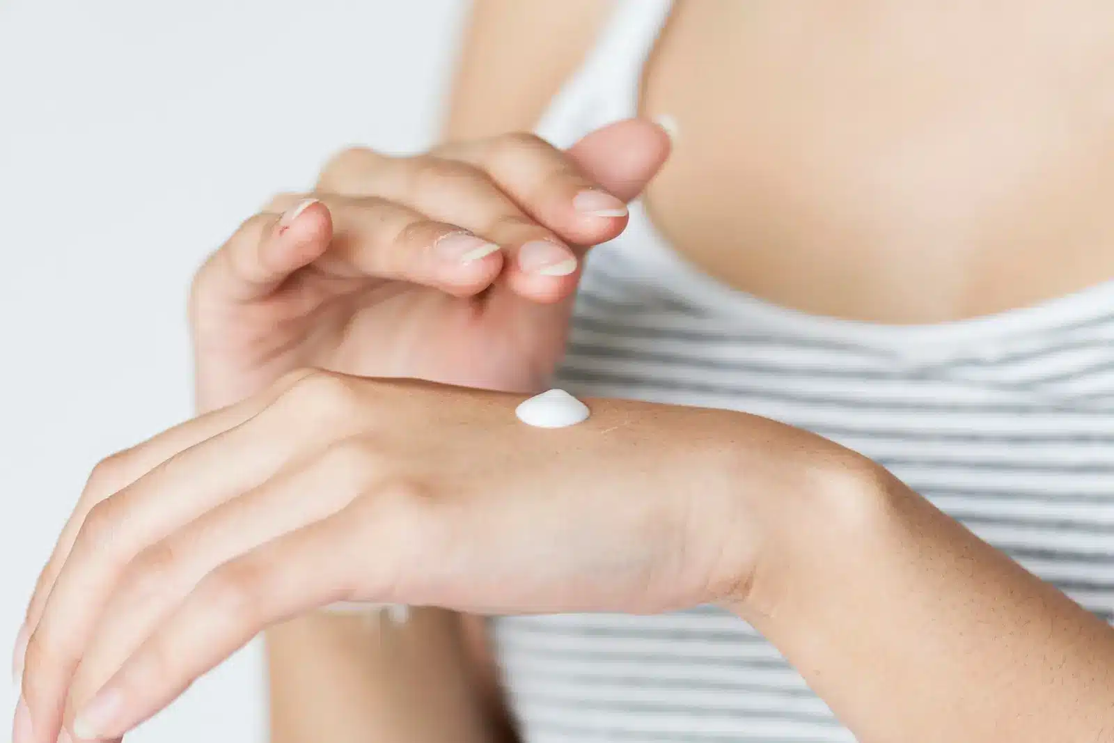 Person with cream on hand.