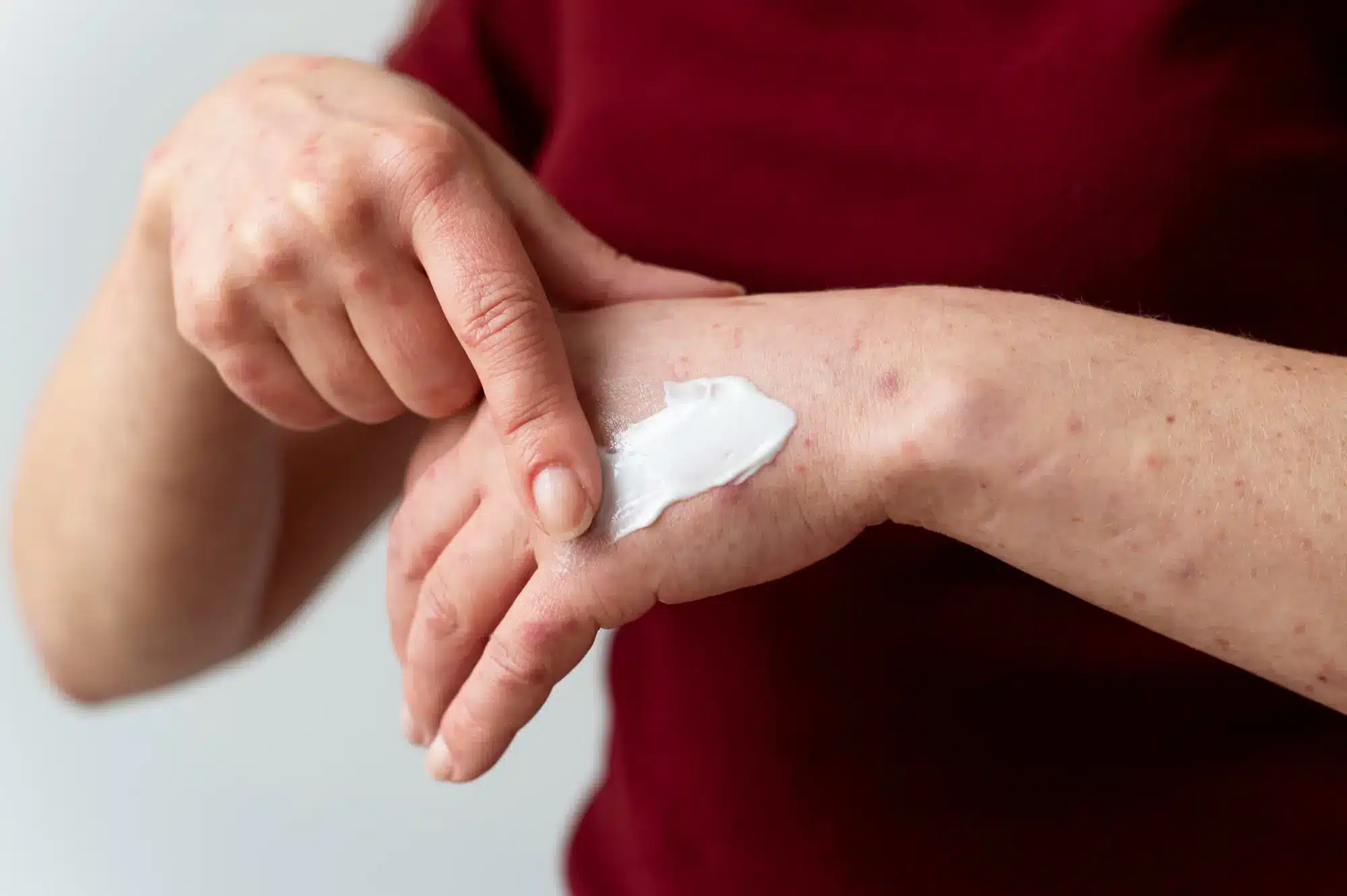 Safety Profiles and Adverse Reaction Considerations